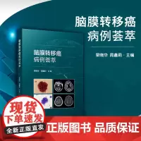 脑膜转移癌病例荟萃 梁晓华,周鑫莉主编 复旦大学出版社 脑膜瘤病案汇编