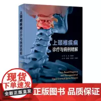 上颈椎疾病诊疗与病例精解 2023年12月参考书 9787117355247