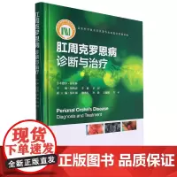 肛周克罗恩病:诊断与治疗