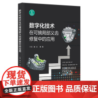数字化技术在可摘局部义齿修复中的应用