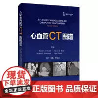 心血管CT图谱