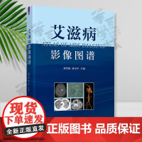 艾滋病影像图谱 刘晋新、唐小平 清华大学出版社 获得性免疫缺陷综合征 影像诊断 图谱 临床医学AIDS艾滋病感染发病演变