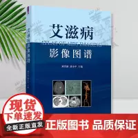 艾滋病影像图谱 刘晋新、唐小平 清华大学出版社 获得性免疫缺陷综合征 影像诊断 图谱 临床医学AIDS艾滋病感染发病演变