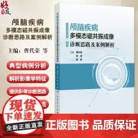 颅脑疾病多模态磁共振成像诊断思路及案例解析 曹代荣 李坚 邢振 常见颅脑疾病多模态磁共振成像典型病例分析 9787117