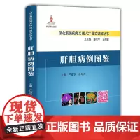 肝胆病例图鉴 严福华 吕培杰 消化系统疾病X线/CT图文详解丛书 肝胆正常解剖 解剖变异与影像学表现CT检查方法书