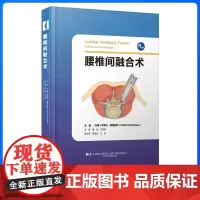 腰椎间融合术