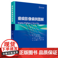 癫痫影像病例图解 2024年7月参考书