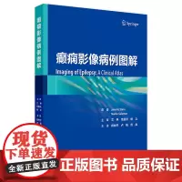 癫痫影像病例图解 2024年7月参考书