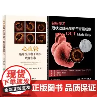 轻松学习冠状动脉光学相干断层成像+心血管临床光学相干断层成像技术 2本套装 人民卫生出版社 OCT在冠状动脉斑块评估 病