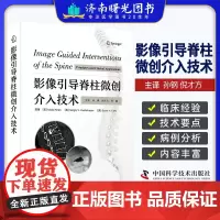 影像引导脊柱微创介入技术 孙钢等译 脊柱介入诊疗基础知识 各类介入技术操作方法技巧及临床实践9787523604861中