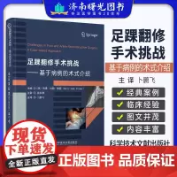 足踝翻修手术挑战:基于病例的术式介绍 哈里约翰维瑟 科学技术文献出版社 应用双钢板配合髓内克氏针翻修移位的 跖骨头截骨术