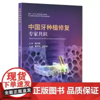 中国牙种植修复专家共识 周学东 王佐林 口腔种植 标准临床路径 美学评价 专家共识 前牙及后牙拔牙窝微创种植方案种植体选