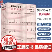 复杂心电图临床精解 冠状动脉粥样硬化性心脏病 结构性心脏病 心肌病与心肌炎 主编 卢喜烈 孙志军 97871173656