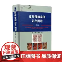 皮瓣移植实例彩色图谱第3三版 邢新 杨超 植皮临床案例教程 美容外科学参考工具书籍 辽宁科学技术出版社9787559