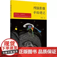 颅脑影像手绘速记 徐桂兴 著 影像医学 正常颅脑影像篇和颅脑病变影像篇 神经急诊重症医学影像等科室医生医学生 人民卫生