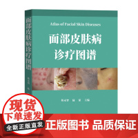 面部皮肤病诊疗图谱 高清典型520余幅照片 注于面部损容性疾病诊疗的专业图谱 看图识病 广东科技出版社正品