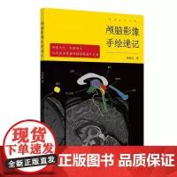 颅脑影像手绘速记 颅脑正常影像 高血压性脑出血 脑静脉出血和静脉窦血栓形成 颅内肿瘤 徐桂兴 人民卫生出版社影像医学