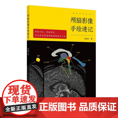 颅脑影像手绘速记 颅脑正常影像 高血压性脑出血 脑静脉出血和静脉窦血栓形成 颅内肿瘤 徐桂兴 人民卫生出版社影像医学