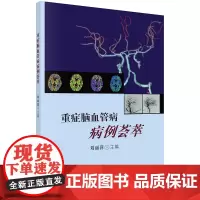 重症脑血管病病例荟萃 刘丽萍 科学出版社 可供神经内科 神经外科及其他相关科室的医生参考 感染性脑卒中 绒毛膜癌脑转移