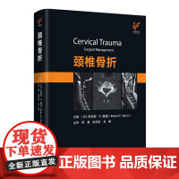 颈椎骨折(精)