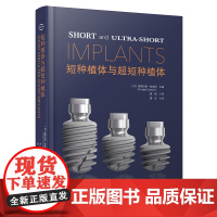 短种植体与超短种植体