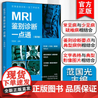 MRI鉴别诊断一点通 第四版 影像鉴别诊断一目了然系列 常见病少见病 一病配多图 病灶指示箭头 表格鉴别要点 影像科医生