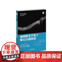 视网膜光学相干断层扫描图谱 邵毅 谭钢主译 糖尿病性视网膜病变 眼科学 糖尿病性黄斑水肿 天津科技翻译出版公司