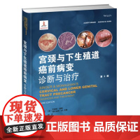 书]宫颈与下生殖道癌前病变诊断与治疗 宫颈癌前病变诊治方法 非感染因素引起的女性宫颈等病症 阴道镜检查