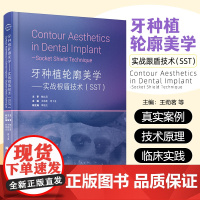 书出版社] 牙种植轮廓美学实战根盾技术SST 赖红昌王劲茗邓飞龙李俊达种植口腔牙医口腔医生口腔医学种植 辽宁科学技术出版