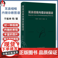 耳鼻咽喉内镜诊断图谱 于振坤 张永辉 倪晓光 介绍了耳鼻咽喉科内镜的分类临床应用等 涵盖了耳鼻咽喉科的全部疾病 人民卫生