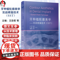 书出版社]牙种植轮廓美学 实战根盾技术(SST)王劲茗 邓飞龙 前牙区的美学修复后牙区全口无牙颌SST技术 辽宁科学技术
