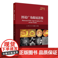 图说广角眼底影像文峰张雄泽吉宇莹视网膜病变眼底炎症感染遗传性玻璃体人民卫生出版社影像诊断学专业眼科医师参考工具书临床