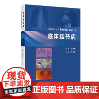 临床结节病 柯会星 人民卫生出版社9787117370554结节病临床诊治病例