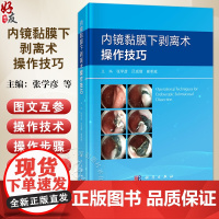 内镜黏膜下剥离术操作技巧 张学彦 吕成倩 崔希威 介绍了内镜黏膜下剥离术(ESD)操作步骤、相关常识及ESD麻醉管理等