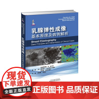 乳腺弹性成像基本原理及病例解析 乳腺病理弹性成像 乳腺疾病治疗 弹性成像和组织应变 应变力弹性成像 乳腺恶性病变解读
