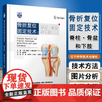 正版 骨折复位固定技术 脊柱、骨盆和下肢 彼得V詹努迪斯 主编 乔林 等主译T微创复位固定技术 978755912223