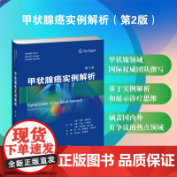 甲状腺癌实例解析 主译:郑向前、关海霞 一本基于实例解析和展示诊疗的甲状腺癌案头书 甲状腺癌-分化型甲状腺癌-甲状腺未分