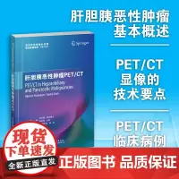 肝胆胰恶性肿瘤PET/CT