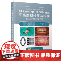 牙齿磨损修复与控制临床实用流程及方法