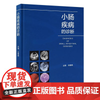 [出版社]小肠疾病的诊断 /9787565926853/165/72/ 北京大学医学出版社