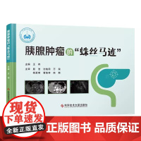 胰腺肿瘤的蛛丝马迹 王伟主编 科学技术文献出版社 胰腺肿瘤不等于胰腺癌 急性胰腺炎 传统影像学检查 超声内镜检查 978