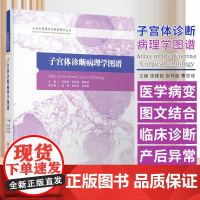 女性生殖器官诊断病例学丛书2子宫体诊断病例学图 张建民等 北京科学技术出版社 慢性子宫内膜炎 慢性非特异性子宫内膜炎