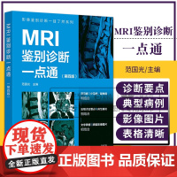 影像鉴别诊断一目了然系列:MRI鉴别诊断一点通(第4四版) 范国光主编 化学工业出版社 文字表格与典型影像图片相结合 颅