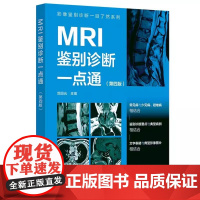 影像鉴别诊断一目了然系列:MRI鉴别诊断一点通(第4四版) 范国光主编 化学工业出版社 文字表格与典型影像图片相结合 颅