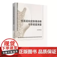 骨质疏松症影像诊断与骨密度测量 程晓光各种骨密度测量方法 双能X线吸收法DXA和定量CTQCT骨密度测量临床诊断应用人民