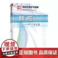 癌症标准手术图解——肺癌