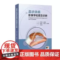 晶状体病影像学检查及诊断 罗莉霞 刘臻臻主编 各类眼科影像学检查方法 正常晶状体的影像学表现等 人民卫生出版社眼科学书籍