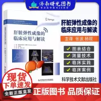 肝脏弹性成像的临床应用与解读 (德)塞巴斯蒂安·穆勒 临床医学 医学书籍 9787523515761 科学技术文献出版社