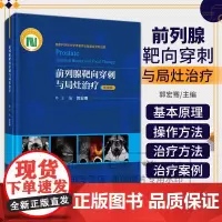 前列腺靶向穿刺与局灶治疗 郭宏骞主编 科学出版社 科学技术学术著作出版基金资助出版 局灶消融策略的制定 光动力治疗
