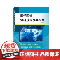 医学图像分析技术及其应用